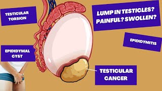 Ive found A Lump In My Testicle Could It Be TESTICULAR CANCER  Causes of Testicular PainLumps [upl. by Gnav]