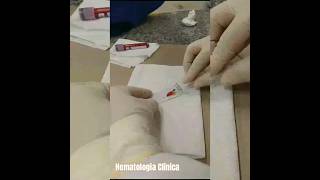 Aula Prática  Hematologia Clínica 🩸shorts study farmacia [upl. by Aryhs]