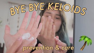 HOW TO TREAT KELOIDS  piercing bump [upl. by Rech]