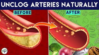 Atherosclerosis Top 10 Foods to Unclog Arteries Naturally and Prevent Heart Attacks [upl. by Gaillard]