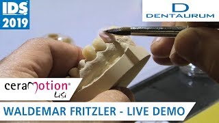 ceraMotion® LiSi auf der IDS 2019 FrontzahnVeneers [upl. by Hairas]