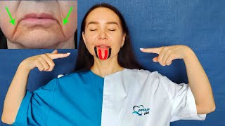 HOW to get rid of Marionette Lines and Lift up Lips corners with Face Taping [upl. by Minne199]