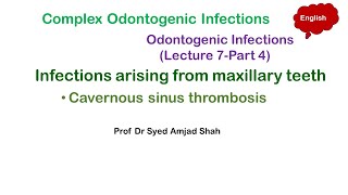 Cavernous sinus thrombosis  Complex Odontogenic Infections  Oral amp Maxillofacial Surgery [upl. by Julee986]