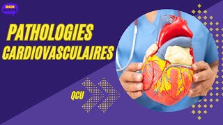 QCU en Pathologies Cardiovasculaires ‐ [upl. by Hayidah490]