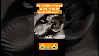 Fetal death😭side effects of vaping during pregnancy😭🙏viralvideo trending viralshorts [upl. by Tonjes]