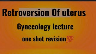 RETROVERSION OF UTERUS  Gynecology lecture [upl. by Polik]