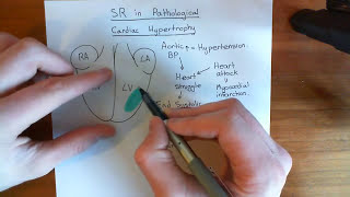 Cardiac Hypertrophy and the Sarcoplasmic Reticulum Part 1 [upl. by Alaet]