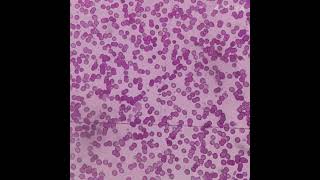 Blood Smear Under Microscope [upl. by Arres]