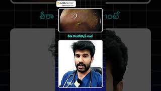 తిన్న వెంటనే మోషన్ వెళ్తున్నారా అయితే ఈ వీడియో చూడండిDrVikranth Chunduri [upl. by Aztiraj]