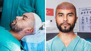 I Went To Turkey For A Hair Transplant [upl. by Popper834]