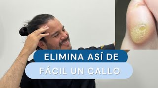 Cómo quitar callos y piel muerta de los pies [upl. by Fanchet]