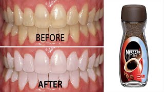 How to whiten teeth naturally with coffee in 2 minutes  Teeth whitening at home [upl. by Brackett]