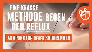 Akupunktur gegen Sodbrennen  Eine krasse Methode gegen den Reflux [upl. by Eugenia13]