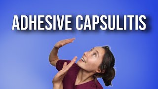 Adhesive Capsulitis [upl. by Gunilla]