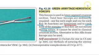 Obstetrics Green Armytage Forceps Use LSCS Cesarean instrument uses real [upl. by Aniarrol]