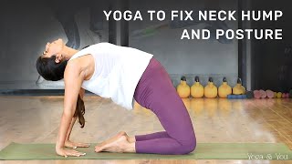 Yoga To Fix Neck Hump And Posture  Neck Hump Exercises  How To Fix A Neck Hump  VentunoYoga [upl. by Brnaby513]