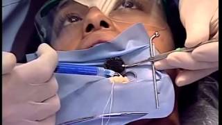 Chair Side Dental Assisting Training Video for Dental Staff [upl. by Macilroy]