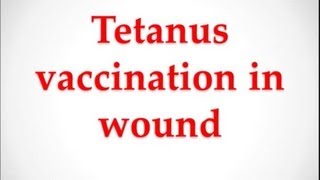 USMLE Medical Video Lectures about tetanus vaccination in wound by UsmleTeam [upl. by Cirded638]