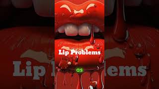 What Are the Most Common Lip Problems and How Can They Be Treated lips shorts fyp foryou [upl. by Jedidiah]