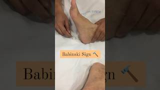 What is babinski reflexsign  neurophysiotherapy reel physiotheraphy [upl. by Legim794]