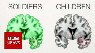 The PTSD brains of children amp soldiers  BBC News [upl. by Blanka167]