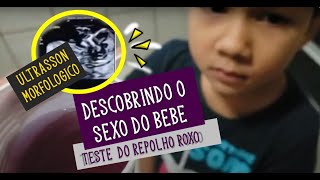 DESCOBRINDO O SEXO DO BEBÊ  TESTE CASEIRO E ULTRASSON MORFOLOGICO [upl. by Haroved]