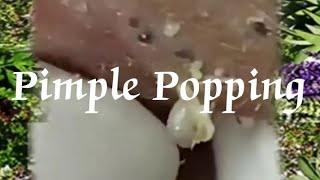 Pimple amp Blackheads Popping  24 [upl. by Dorelia]