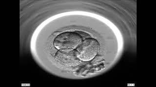 Embryoscope at Fertility Specialists of WA [upl. by Eleahcim]