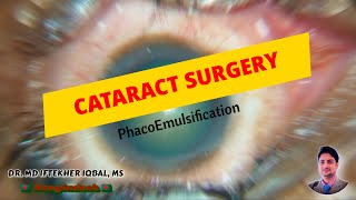 MIIQ 107 Cataract Surgery ছানি অপারেশন  Phaco Surgery and SonyXperia DR MD IFTEKHER IQBAL RAJU [upl. by Teodorico482]