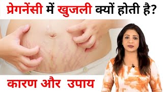 Itching problem during pregnancy  प्रेगनेंसी में खुजली क्यों होती है कारण और उपाय Sonal Parihaar [upl. by Joyann]