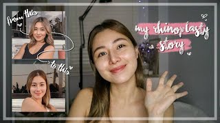 My Rhinoplasty Story  Kath Figuracion [upl. by Eytak]