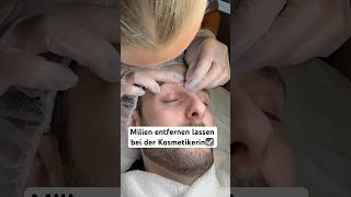 Milien entfernen☑️ hautpflege skincare gesichtsbehandlung kosmetiker ausreinigen [upl. by Kelsi967]