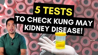 5 Tests Para Malaman Kung May Kidney Disease [upl. by Lamberto]