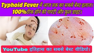 Typhoid fever causessymptomstestdiet and full treatment मोतीझरा का इलाजलक्षण कारणजांचे परहेज। [upl. by Anihtyc]