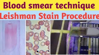 PERIPHERAL BLOOD SMEAR  HAEMATOLOGY LAB  LEISHMAN STAIN PHYSIOLOGY PRACTICALS [upl. by Atnom]