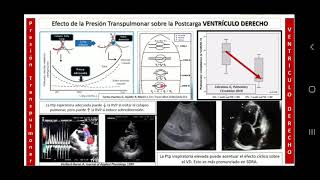 Impacto Hemodinamico en ventilacion Mecanica en Covid DrAlberto lezcano Alva World Sepsis Meeting [upl. by Nwadrebma]