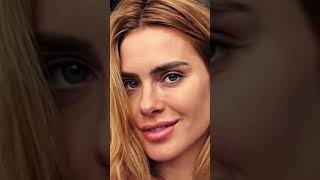 ⚠️Carolina Dieckmann sofre acidente durante filmagem carolinadieckmann acidente filmagem [upl. by Ralip]