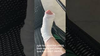 foot stretches on day 42 after midfoot fusion surgery [upl. by Auahsoj]