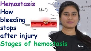 Hemostasis  Stages  Vasospasm  Clot Retraction amp Repair  Clotting of Blood  Breakdown of Clot [upl. by Notselrahc]