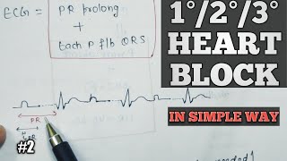 FirstsecondThird degree heart block  Cardiac arrhythmia in hindi  Av block  2 [upl. by Kenta]