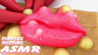 Pimple Popping on HyperRealistic Silicone Body Models 🛑Live Stream [upl. by Nahgrom]