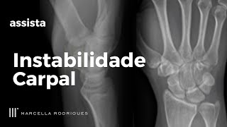 INSTABILIDADE CARPAL Aprenda a Diagnosticar e Tratar [upl. by Vassell]