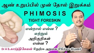 Phimosisஆண் உறுப்பில் முன் தோல் இறுக்கம் என்றால் என்னஅதன் அறிகுறிகள் என்ன Tight foreskinSymptoms [upl. by Kiki338]