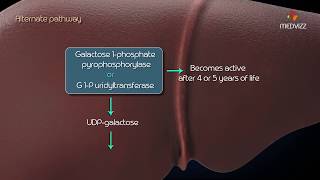 Metabolism of galactose Classic Galactosemia Galactokinase deficiency [upl. by Leiba]