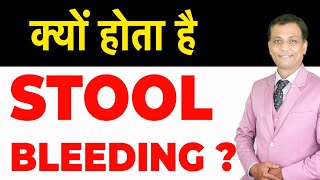 मल में खून आना  Stool Bleeding  Blood in Stool Causes Symptoms amp Treatment Dr Dipak Pileslaser [upl. by Ailegave]