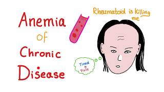 Anemia of Chronic Disease  Anemia of Inflammation All you need to know  Hematology Series [upl. by Bikales]