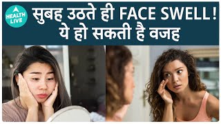 Facial Swelling in Morning  Here’s why  How to get rid of Morning Facial swelling  Health Live [upl. by Sixela915]