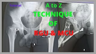 Technique of RGU amp MCU Ep31 Retrograde rethrogram and Micturating cystogram  Bangla Tutorial [upl. by Charmine]