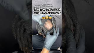 Bald Spot Gone😨🤣🤯  Why She Spread it Like That😱 [upl. by Noitsirhc]