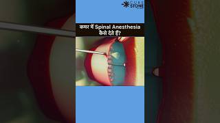 Spinal Anesthesia  How spinal is given  Epidural Anesthesia rirssurgery pregenency [upl. by Oemac]